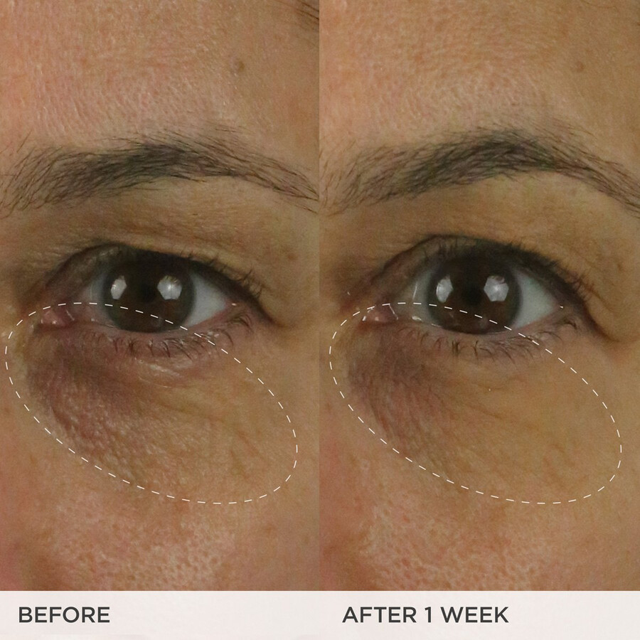 crème contour des yeux éclaircissante et réduction des cernes